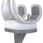 Freedom-Primary-Knee-Porous-Femor-Full-construct-angle-2-815x1024