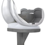 Freedom-Primary-PCK-regular-baseplate-Full-Construct-Angle-1-1-885x1024